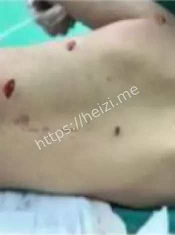 教育局威胁删帖争议