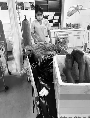 垃圾车作业与道路安全