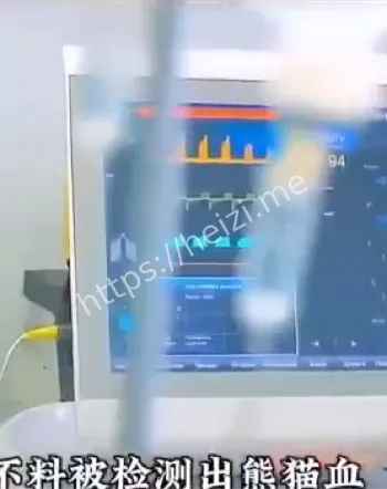 王思俊云南8岁女孩脑死亡