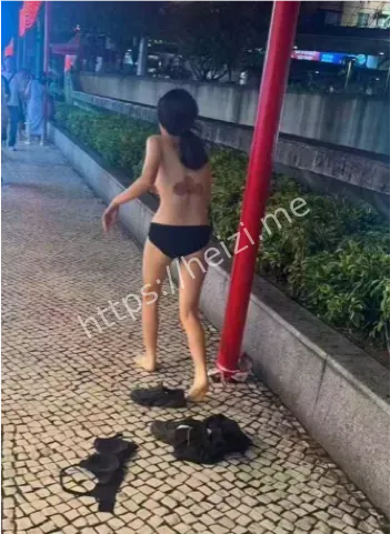 25岁女子扶梯跌倒受伤